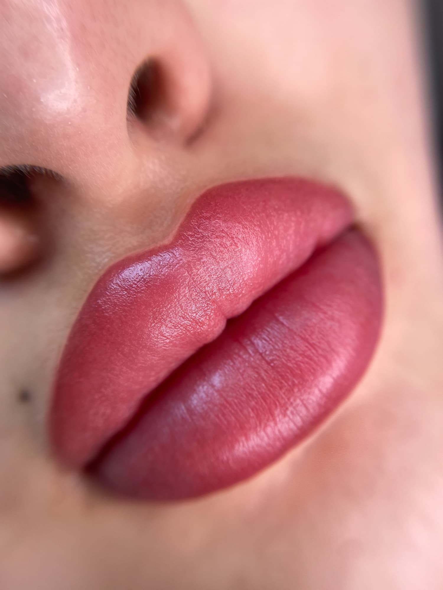 Resultaat van een lipbehandeling.