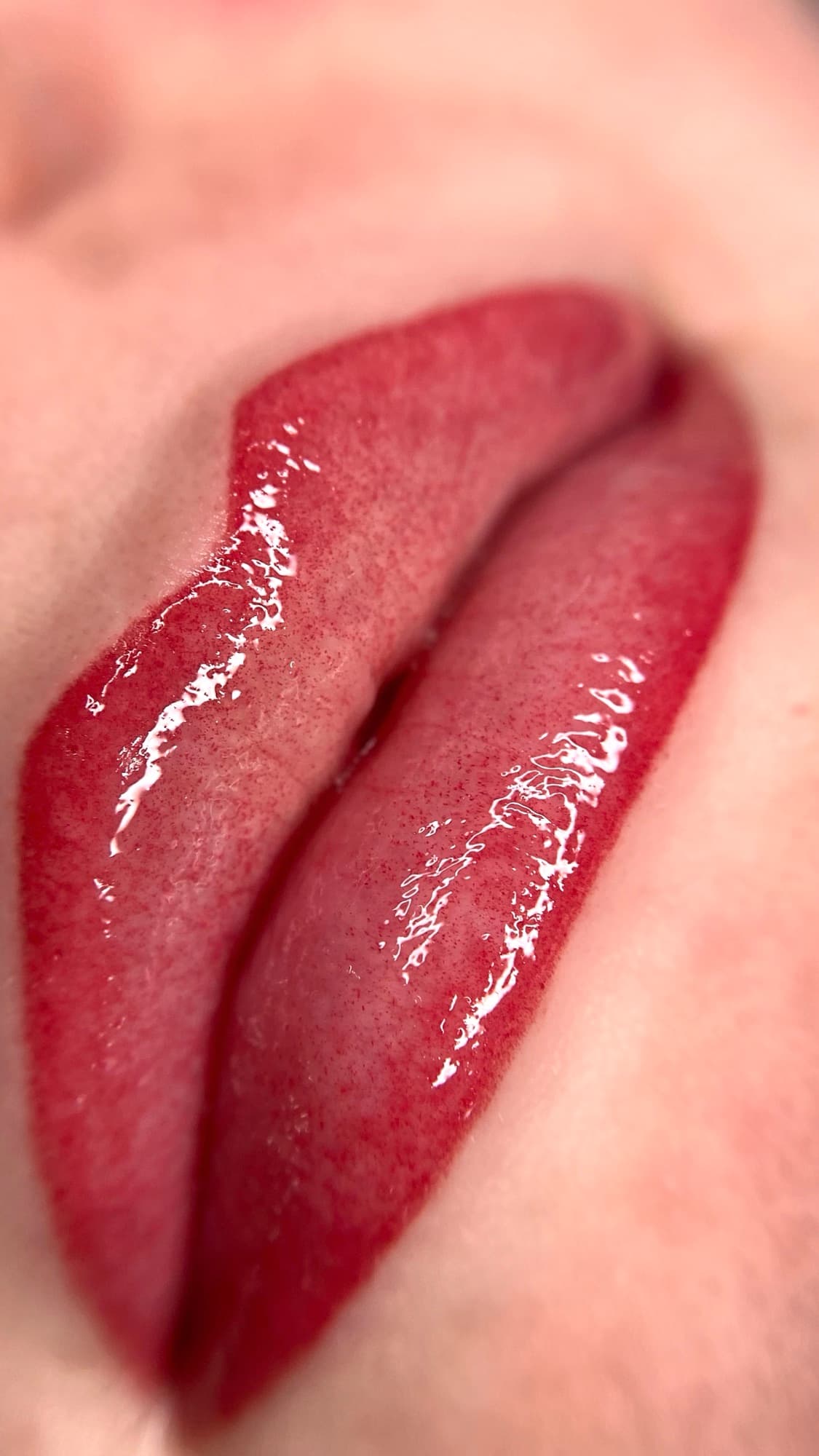 Resultaat van een lipbehandeling.