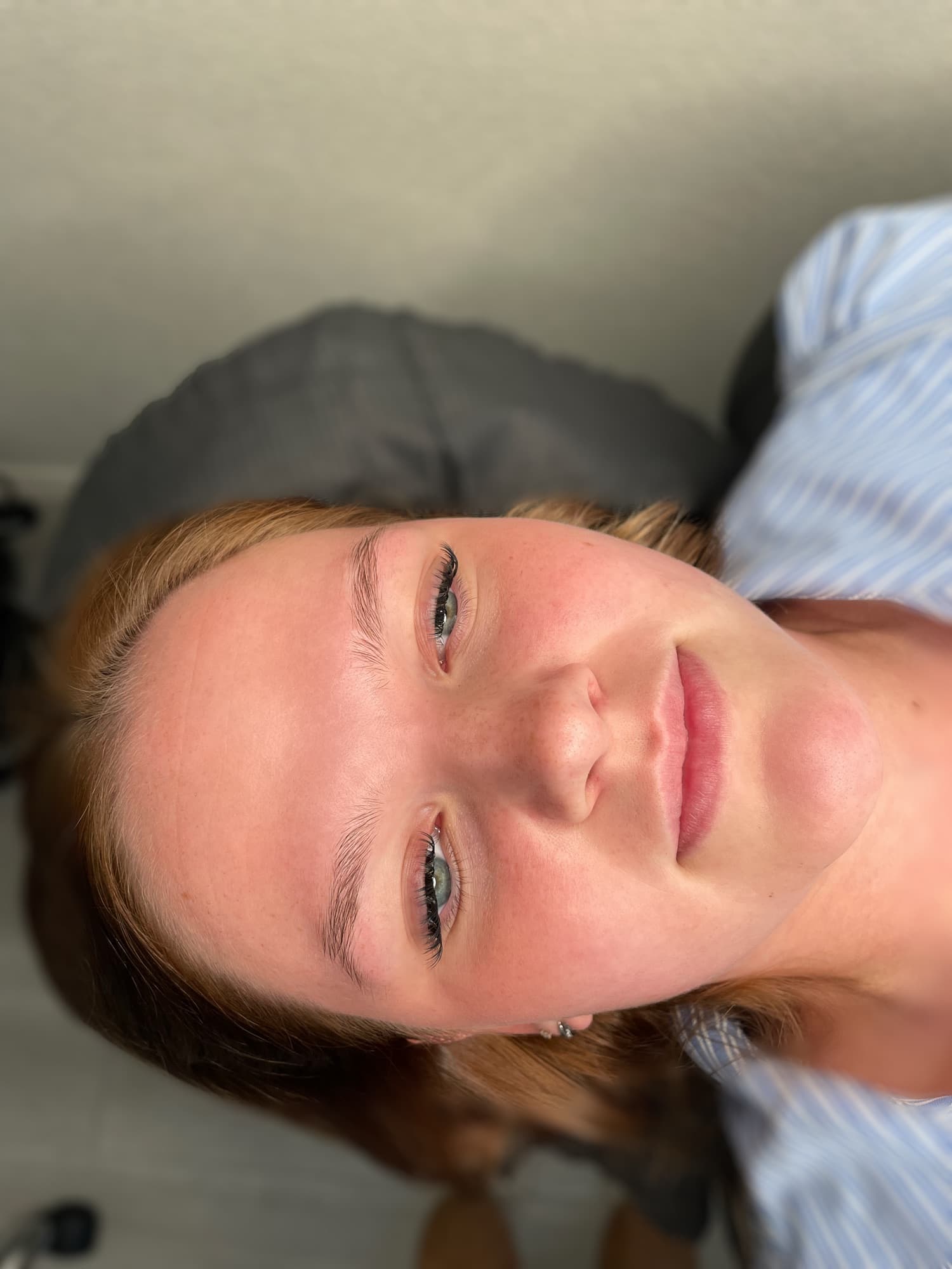 Resultaat van een lipbehandeling.