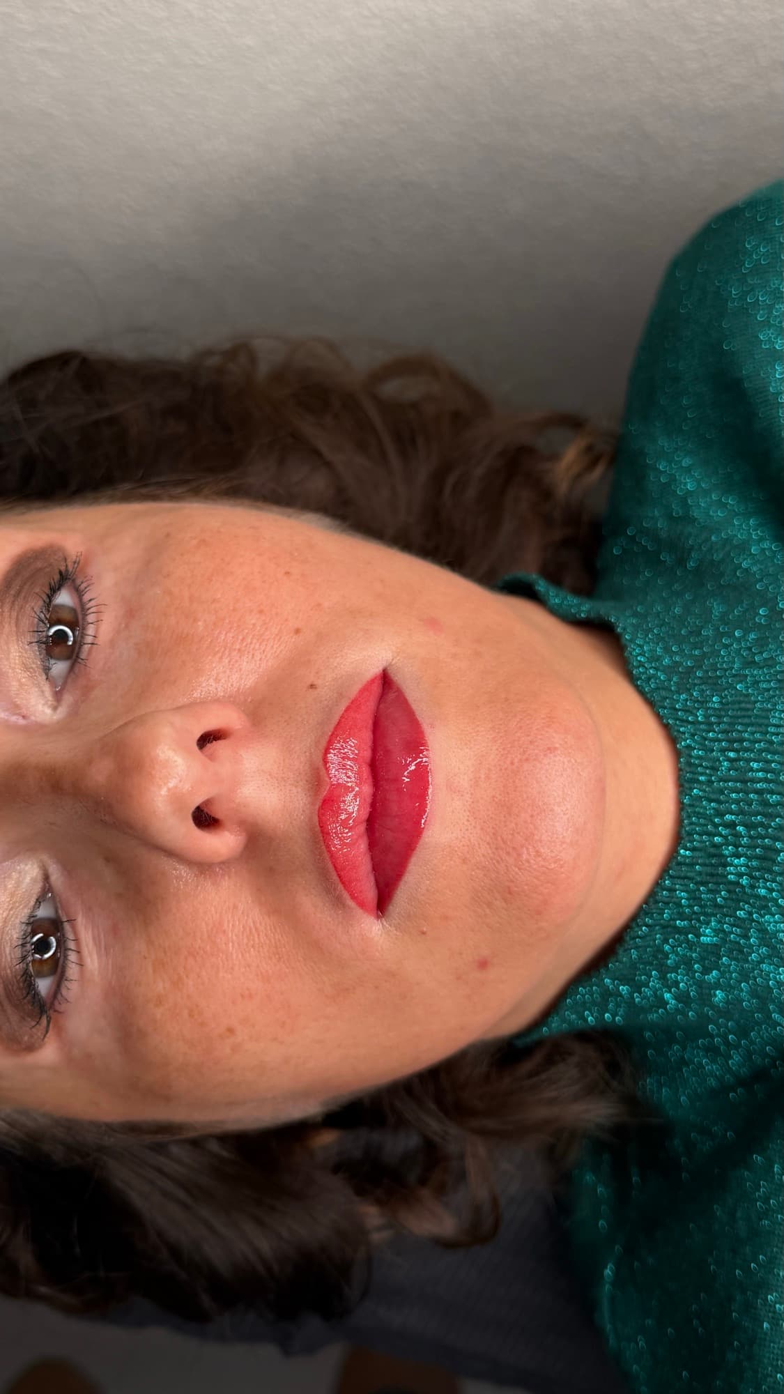 Resultaat van een lipbehandeling.